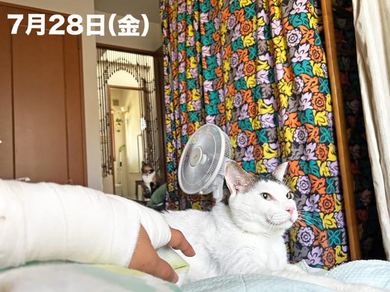ギプス装着中の寝起き写真